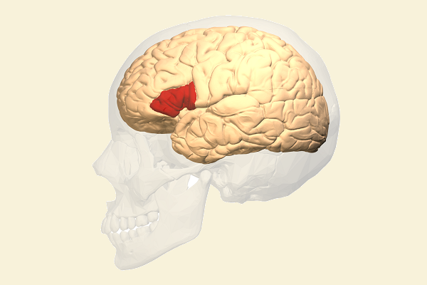 Afasia de Broca: SÍNTOMAS y CAUSAS que Debes Conocer 2 afasia de broca sintomas y causas que debes conocer
