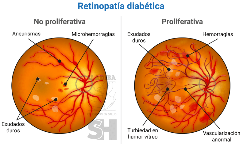Anatomía de la Retina: Descubre Funciones Clave en Madrid 18 anatomia de la retina descubre funciones clave en madrid
