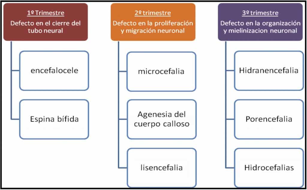 anencefalia prevencion y diagnostico online en madrid