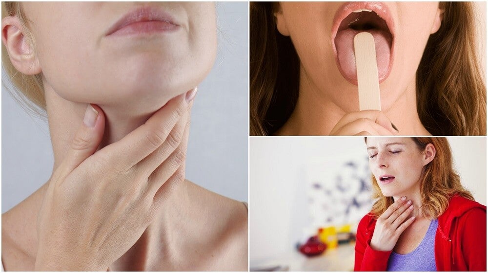 CÁNCER DE GARGANTA: 9 SÍNTOMAS que NO debes Ignorar 2 cancer de garganta 9 sintomas que no debes ignorar