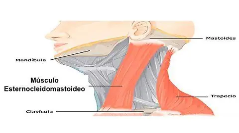 contractura esternocleidomastoideo funciones y soluciones