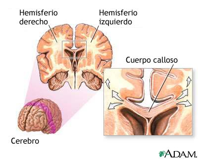 Corpúsculo Calloso: Ubicación y Funciones Sorprendentes 28 corpusculo calloso ubicacion y funciones sorprendentes