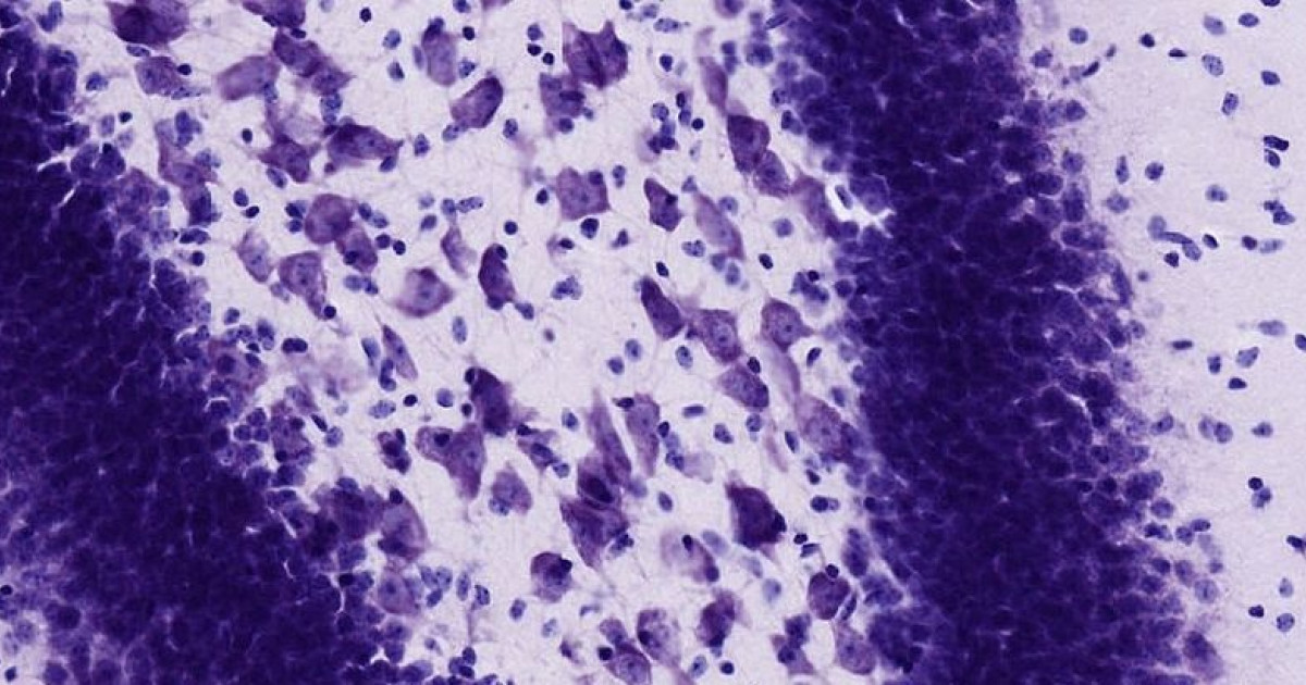 Cuerpos de NISSL: ANATOMÍA y FUNCIONES en el CEREBRO 2 cuerpos de nissl anatomia y funciones en el cerebro