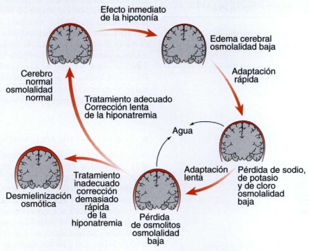 Depresión Refractaria: Descubre Soluciones Efectivas 2 depresion refractaria descubre soluciones efectivas