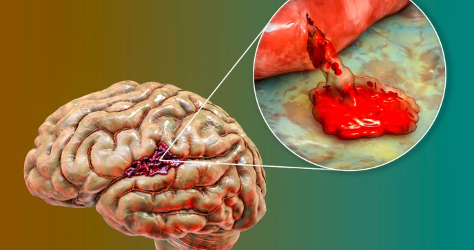 Descubre cómo la Variabilidad Cardíaca afecta tu Cerebro 21 descubre como la variabilidad cardiaca afecta tu cerebro