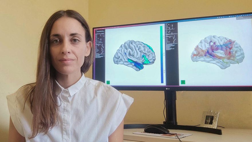 Descubre el Fascículo Cerebral: Terapia Innovadora en Madrid 2 descubre el fasciculo cerebral terapia innovadora en madrid