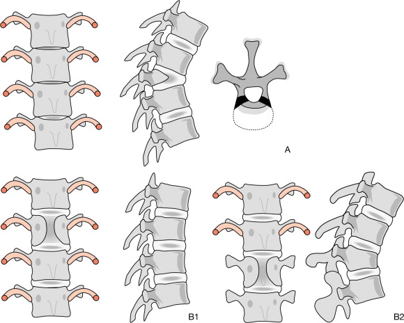 Descubre el Locus del Sistema Locomotor: Claves Esenciales 2 descubre el locus del sistema locomotor claves esenciales