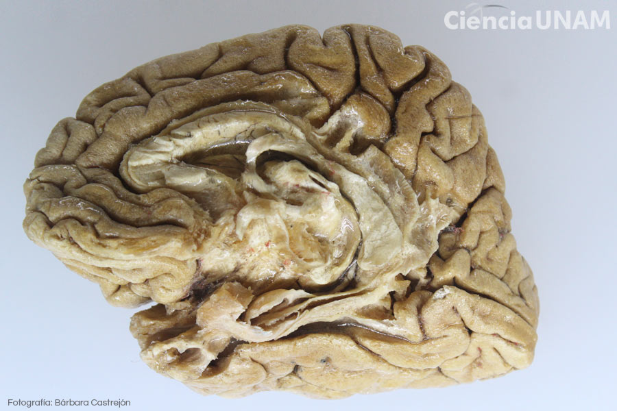 Descubre la Ubicación del Cerebro y su Anatomía Sorprendente 19 descubre la ubicacion del cerebro y su anatomia sorprendente