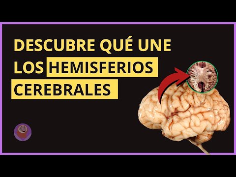 Descubre las Sorprendentes Funciones del Hemisferio Derecho 2 descubre las sorprendentes funciones del hemisferio derecho