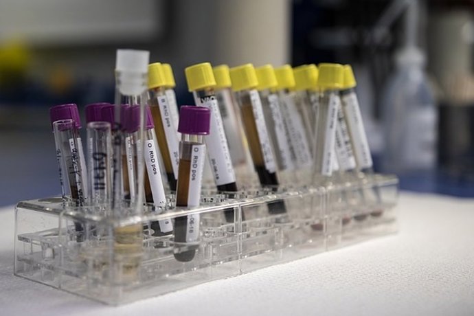 descubre los claves de los neurofilamentos en madrid