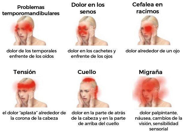 DOLOR de CABEZA por ANSIEDAD - CAUSAS y SOLUCIONES EFECTIVAS 4 dolor de cabeza por ansiedad causas y soluciones efectivas