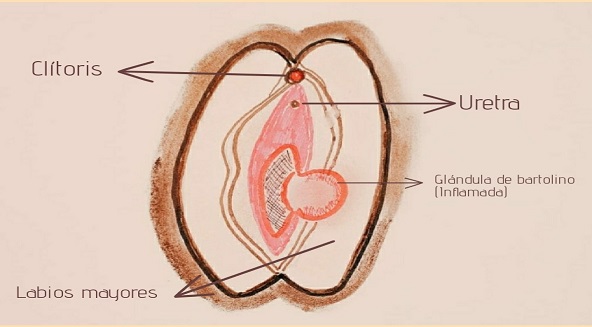 DOLOR en los LABIOS GENITALES: TIPOS, SÍNTOMAS y TRATAMIENTO 2 dolor en los labios genitales tipos sintomas y tratamiento