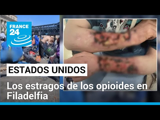 Drogas COCODRILO: Efectos TERRIBLES de la DROGA ZOMBIE 2 drogas cocodrilo efectos terribles de la droga zombie