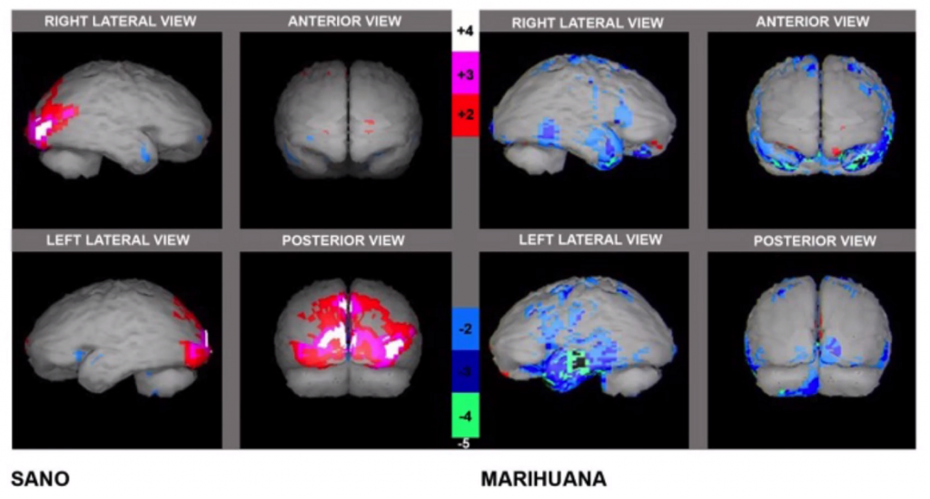 Efectos POSITIVOS y NEGATIVOS de la MARIHUANA en el CEREBRO 2 efectos positivos y negativos de la marihuana en el cerebro