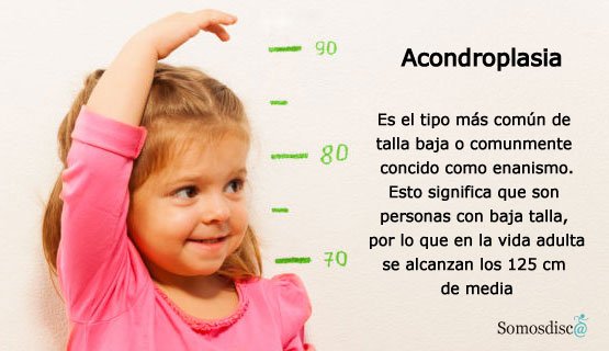 Enanismo: TODO sobre CAUSAS y SÍNTOMAS que Debes Saber 2 enanismo todo sobre causas y sintomas que debes saber