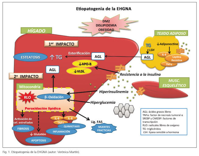 esteatosis hepatica sintomas y tratamiento eficaz en madrid