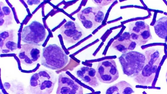 Eubacteria: EJEMPLOS CLAVE y CARACTERÍSTICAS ESENCIALES 2 eubacteria ejemplos clave y caracteristicas esenciales