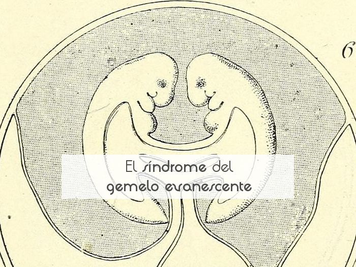 Evanescencia Emocional: ¡analiza Nuestra Experiencia Única! 2 evanescencia emocional analiza nuestra experiencia unica