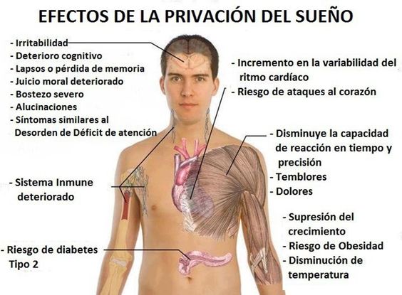 falta de sueno sintomas y efectos que debes conocer