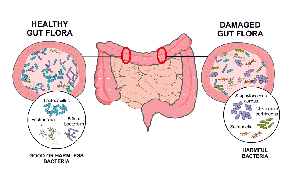 FLORA INTESTINAL: Qué es y su IMPORTANCIA para tu SALUD 2 flora intestinal que es y su importancia para tu salud
