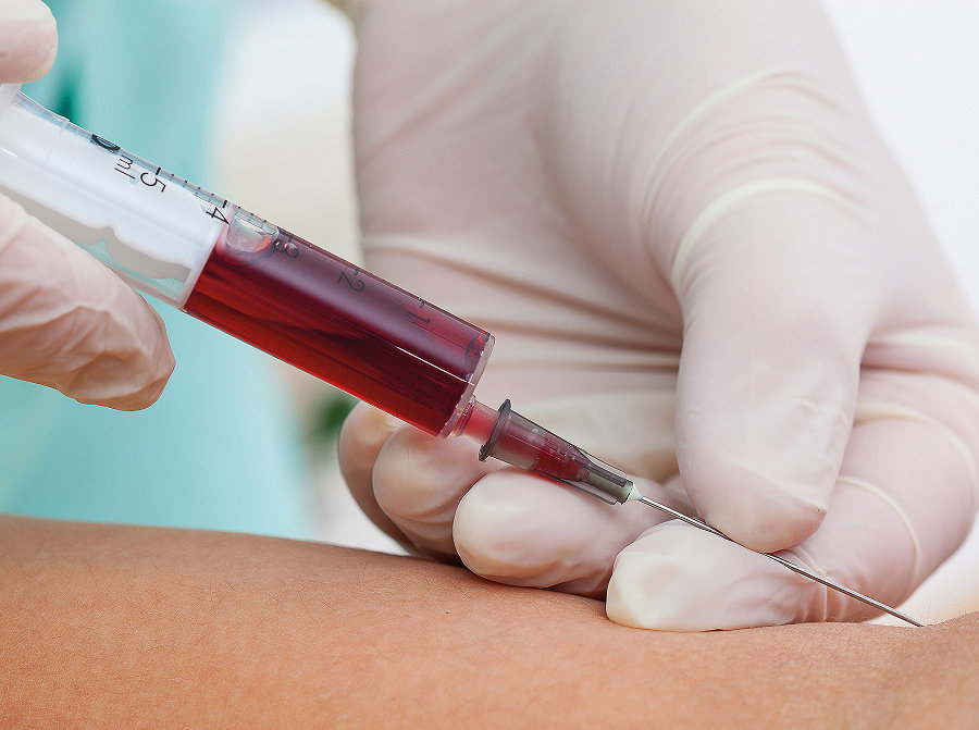 Fobia a las EXTRACCIONES de SANGRE - Supera tu HEMATOFOBIA 2 fobia a las extracciones de sangre supera tu hematofobia
