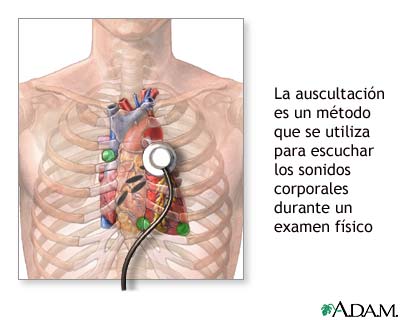 FOCOS CARDÍACOS: Claves Esenciales que Debes Conocer 2 focos cardiacos claves esenciales que debes conocer