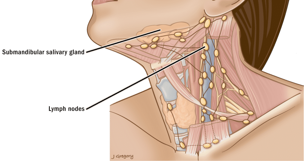 ganglios inflamados en el cuello causas y sintomas clave