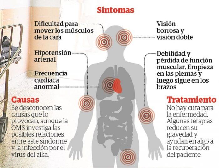 Guillan-Barré: Tratamiento Efectivo y Manejo en Madrid 2 guillan barre tratamiento efectivo y manejo en madrid