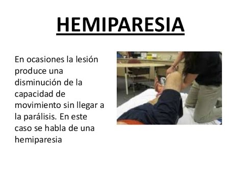 Hemiparesia: QUÉ ES Síntomas y TRATAMIENTO Efectivo 2 hemiparesia que es sintomas y tratamiento efectivo