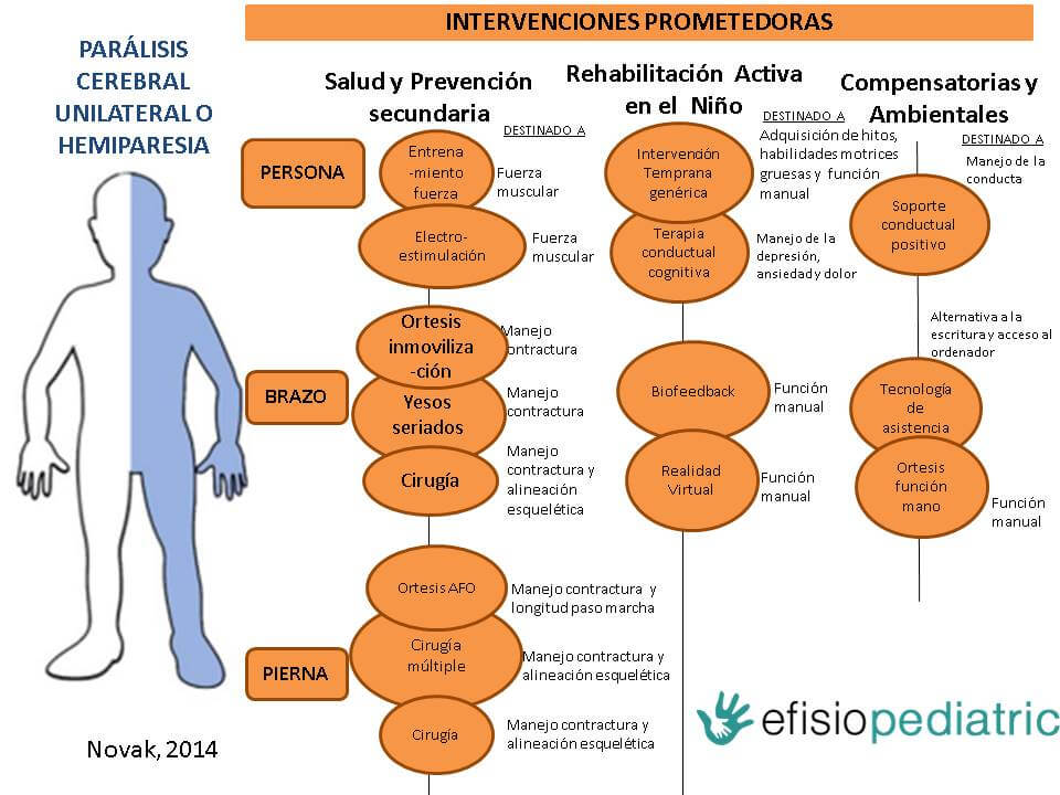 Hemiparesia: SIGNIFICADO, DEFINICIÓN y TRATAMIENTO EFECTIVO 2 hemiparesia significado definicion y tratamiento efectivo