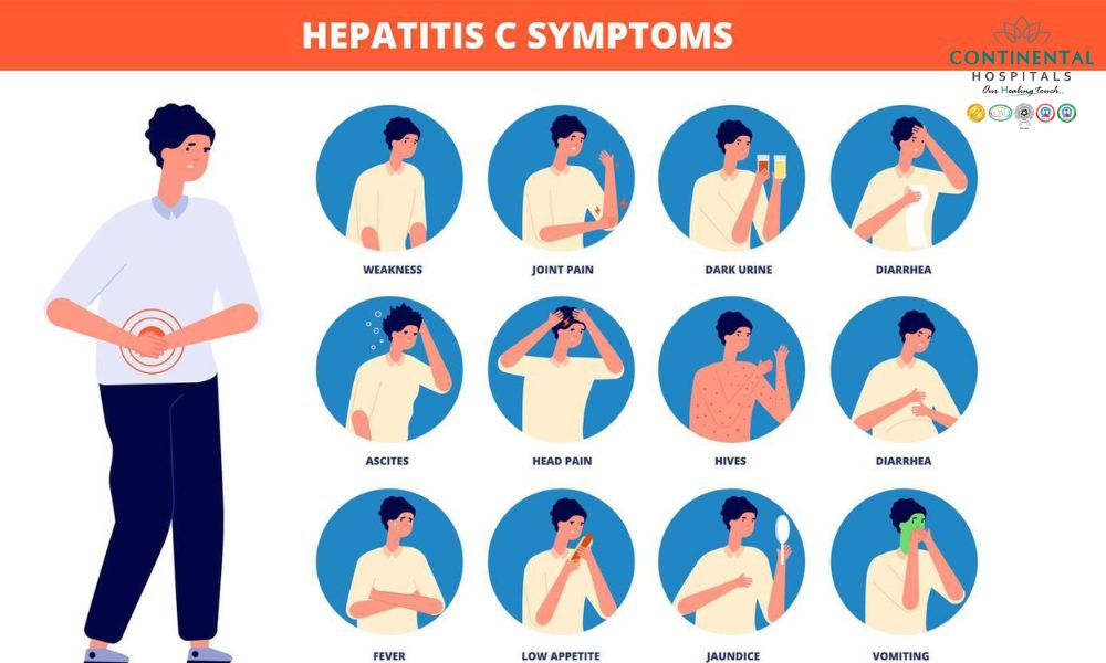 HEPATITIS: Qué es, TIPOS, SÍNTOMAS y TRATAMIENTOS Esenciales 2 hepatitis que es tipos sintomas y tratamientos esenciales