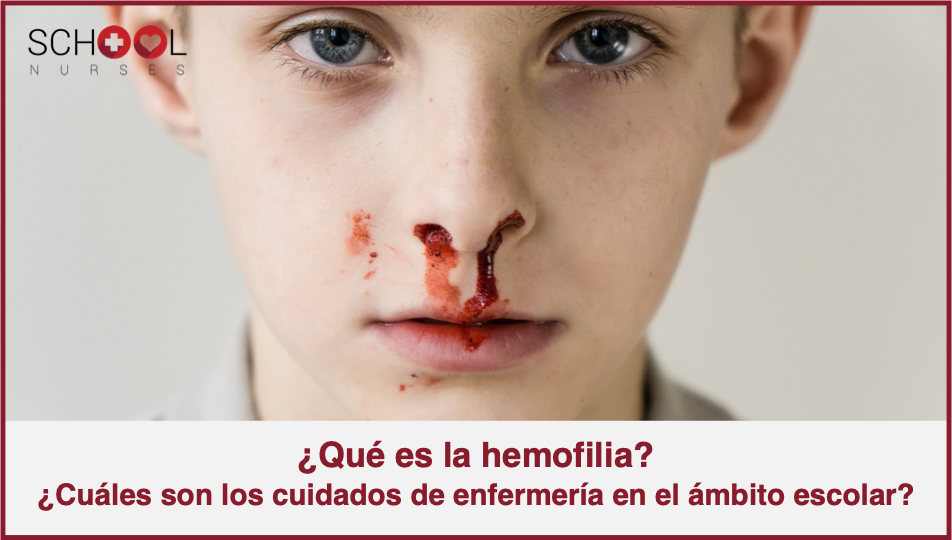homofilia que es y por que es importante en tu vida
