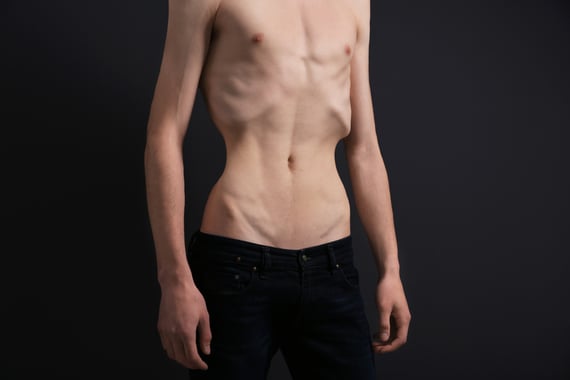 impacto de la anorexia efectos fisicos y emocionales