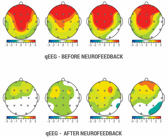 Inestabilidad EMOCIONAL: Diagnóstico y TRATAMIENTO en Madrid 2 inestabilidad emocional diagnostico y tratamiento en madrid