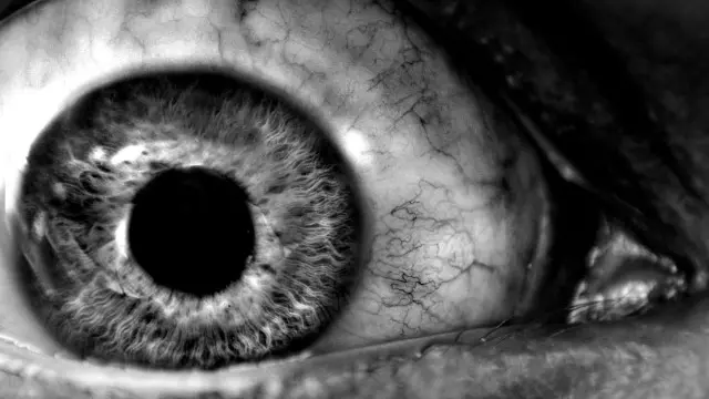 INSOMNIO FATAL: Causas y Consecuencias MURIENDO DE SUEÑO 2 insomnio fatal causas y consecuencias muriendo de sueno