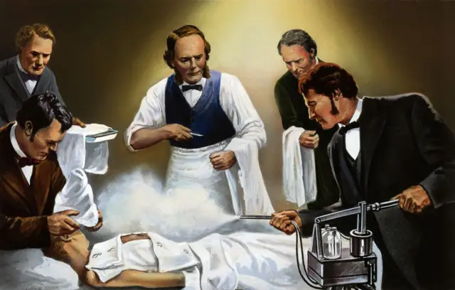 Joseph Lister: El Cirujano que Transformó la Medicina 2 joseph lister el cirujano que transformo la medicina