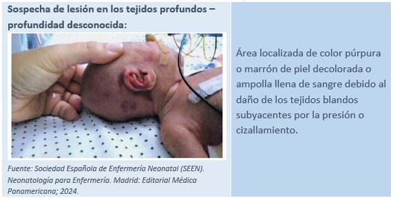 LANUGO en BEBÉS - Descubre sus CARACTERÍSTICAS y FUNCIONES 2 lanugo en bebes descubre sus caracteristicas y funciones