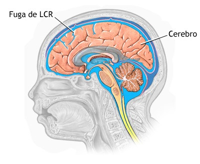 Líquido Cefalorraquídeo: Funciones Clave y Características 2 liquido cefalorraquideo funciones clave y caracteristicas