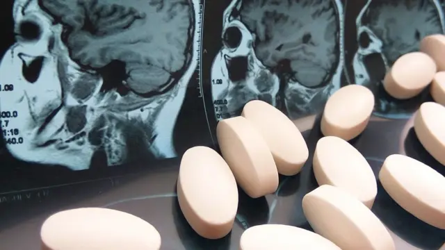 Los ANTIDEPRESIVOS DAÑAN el CEREBRO DESCUBRE la VERDAD AQUÍ 2 los antidepresivos danan el cerebro descubre la verdad aqui