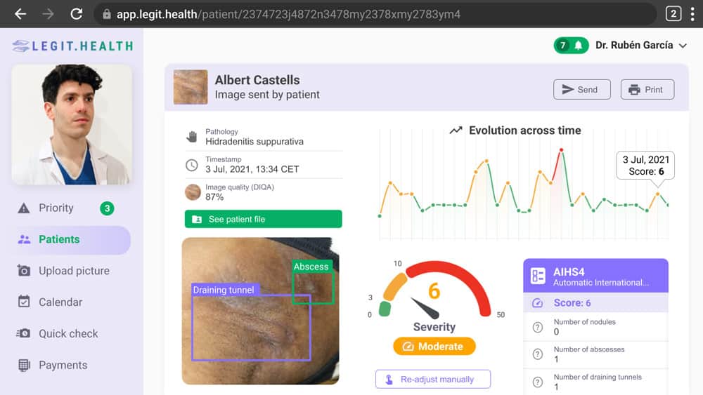 MERE EXPOSURE: Definición y APLICACIONES en Terapia Online 2 mere exposure definicion y aplicaciones en terapia online