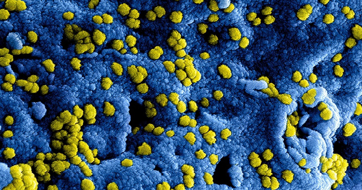 Microbiología: 5 MOTIVOS CLAVE para ESTUDIAR esta CIENCIA 2 microbiologia 5 motivos clave para estudiar esta ciencia