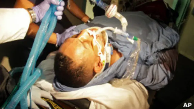 Muerte Cerebral: Consecuencias y Lo que Debes Saber 2 muerte cerebral consecuencias y lo que debes saber