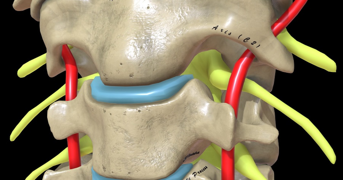 nervios raquideos claves y tipos esenciales en madrid