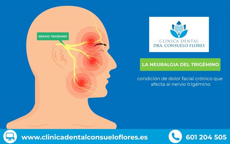 Neuralgia del Trigémino: Síntomas y Tratamientos Efectivos 2 neuralgia del trigemino sintomas y tratamientos efectivos