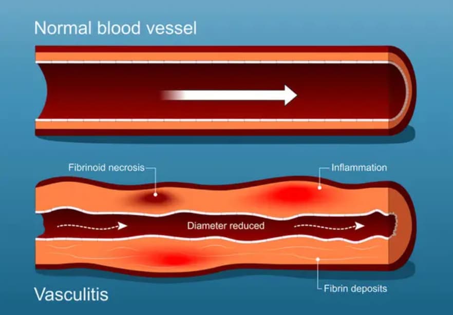 nk cells funciones esenciales en tu salud terapia online