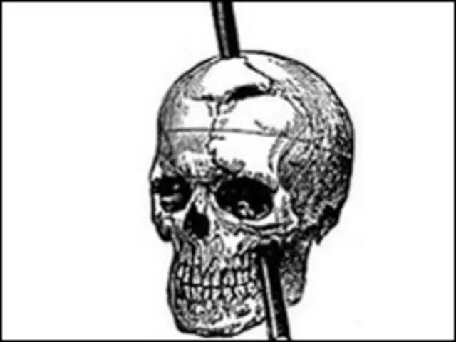 PHINEAS GAGE: El CASO que REVOLUCIONÓ la PSICOLOGÍA 2 phineas gage el caso que revoluciono la psicologia