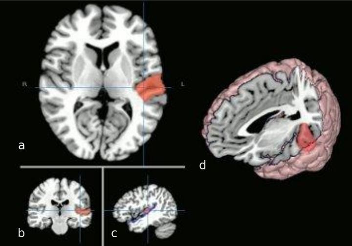 primary auditory cortex funciones y localizacion esencial