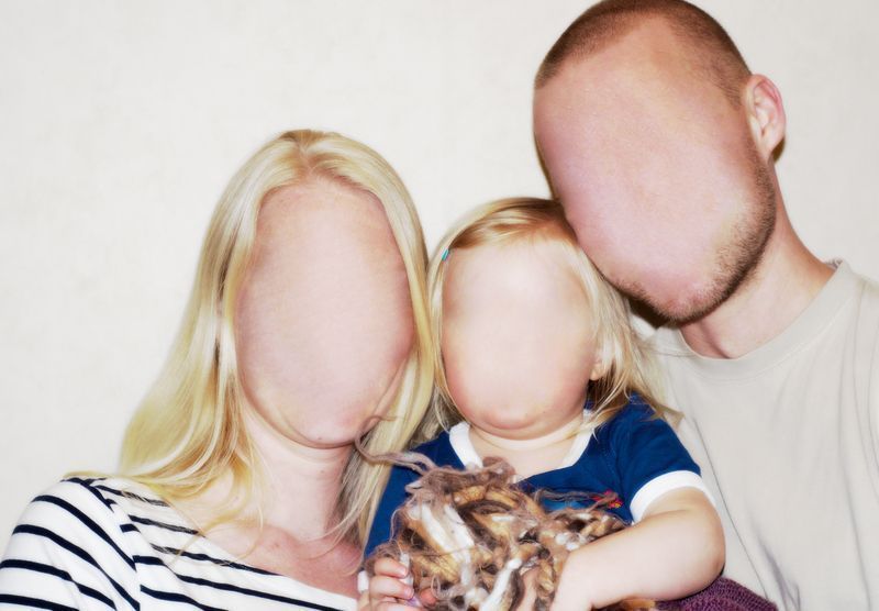 prosopagnosia que es sintomas y tratamientos claves