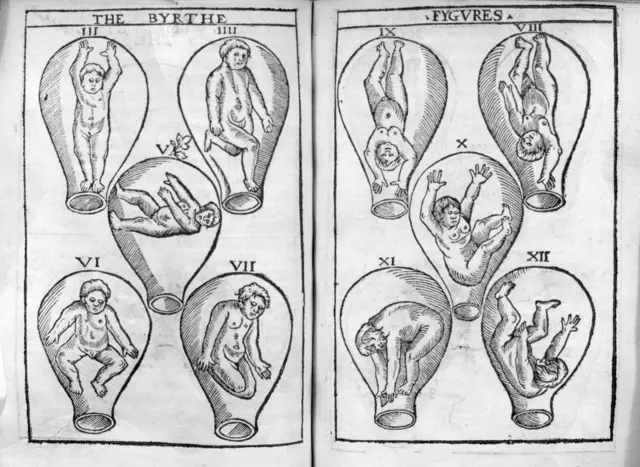 que es la histeria descubre su origen y sintomas clave