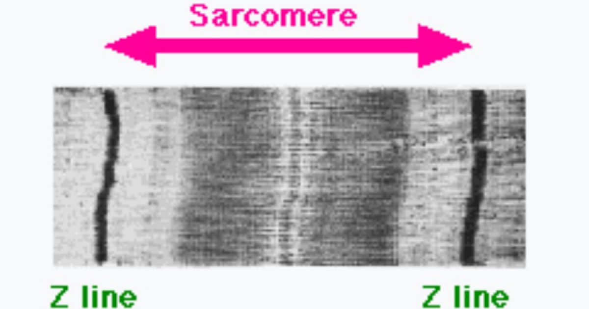 SARCÓMERO: PARTES y FUNCIONES ESENCIALES en la SALUD 2 sarcomero partes y funciones esenciales en la salud